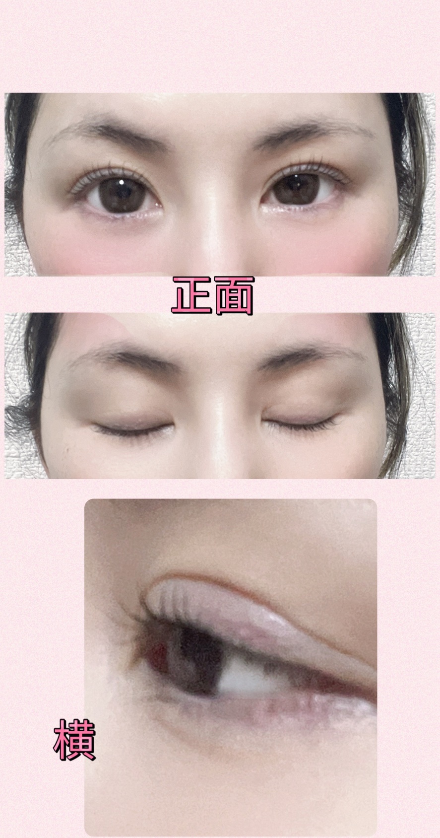 アイラッシュセラム/ETUDE/まつげ美容液を使ったクチコミ（3枚目）