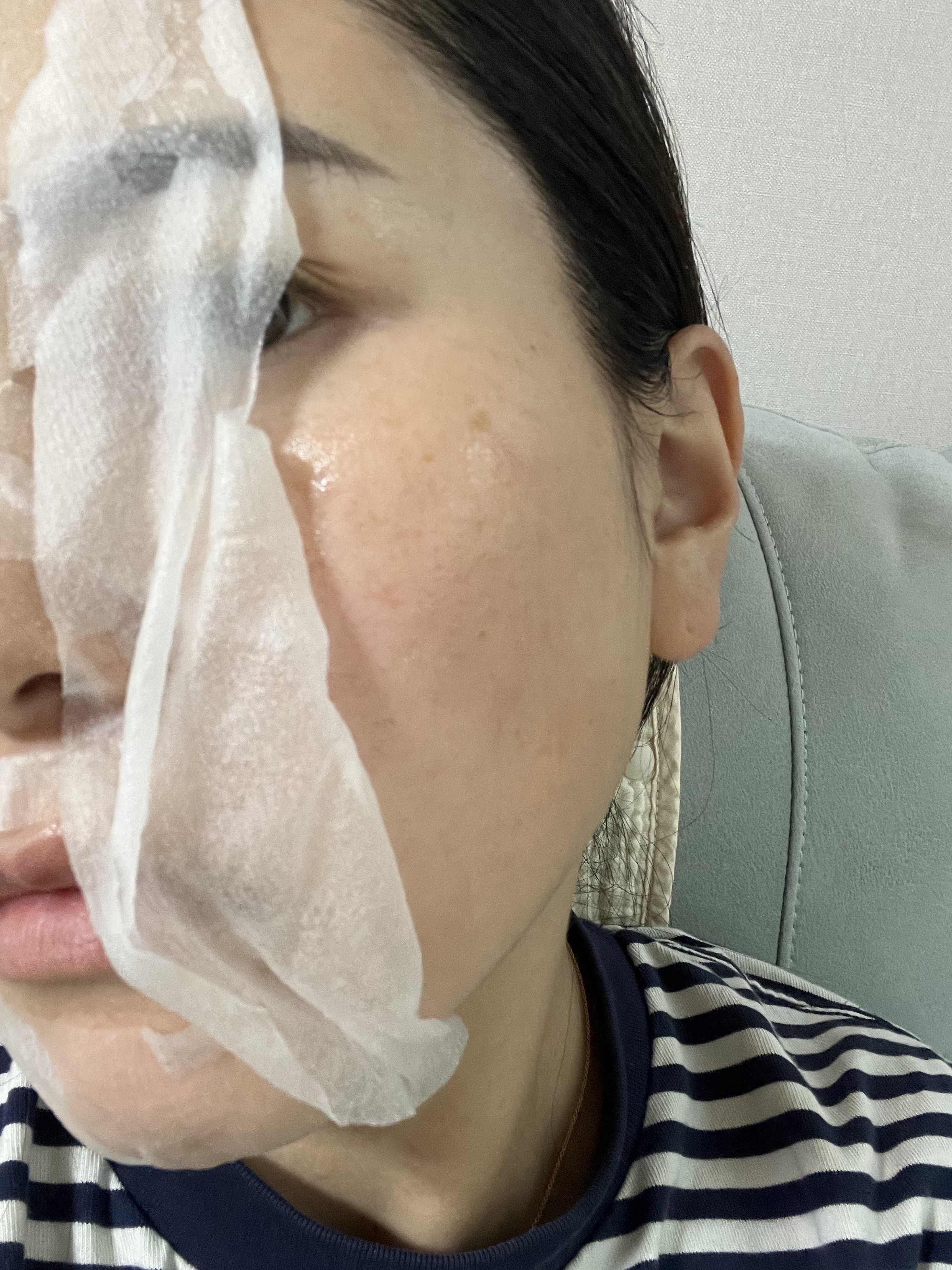 ドクダミシートマスクデイリーピック/Abib /シートマスク・パックを使ったクチコミ（3枚目）