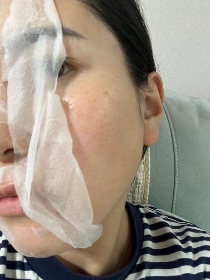 ドクダミシートマスクデイリーピック/Abib /シートマスク・パックを使ったクチコミ(3枚目)