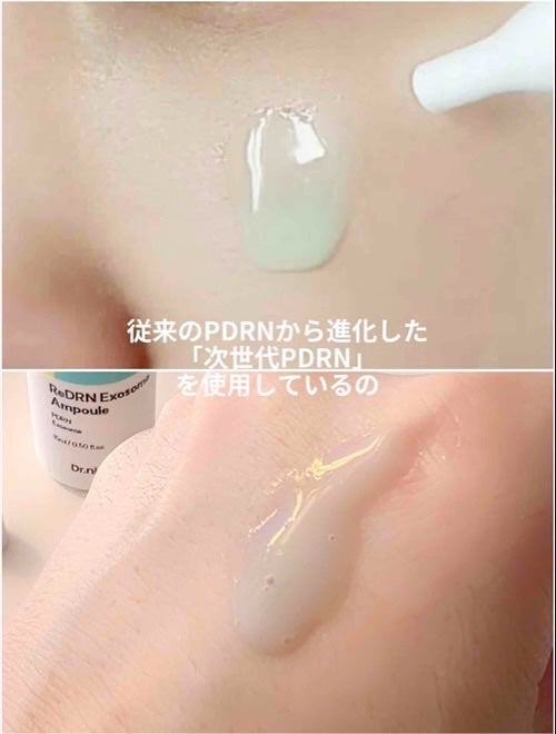 ReDRNエクソソームアンプル/Dr.nineteen/美容液を使ったクチコミ(4枚目)