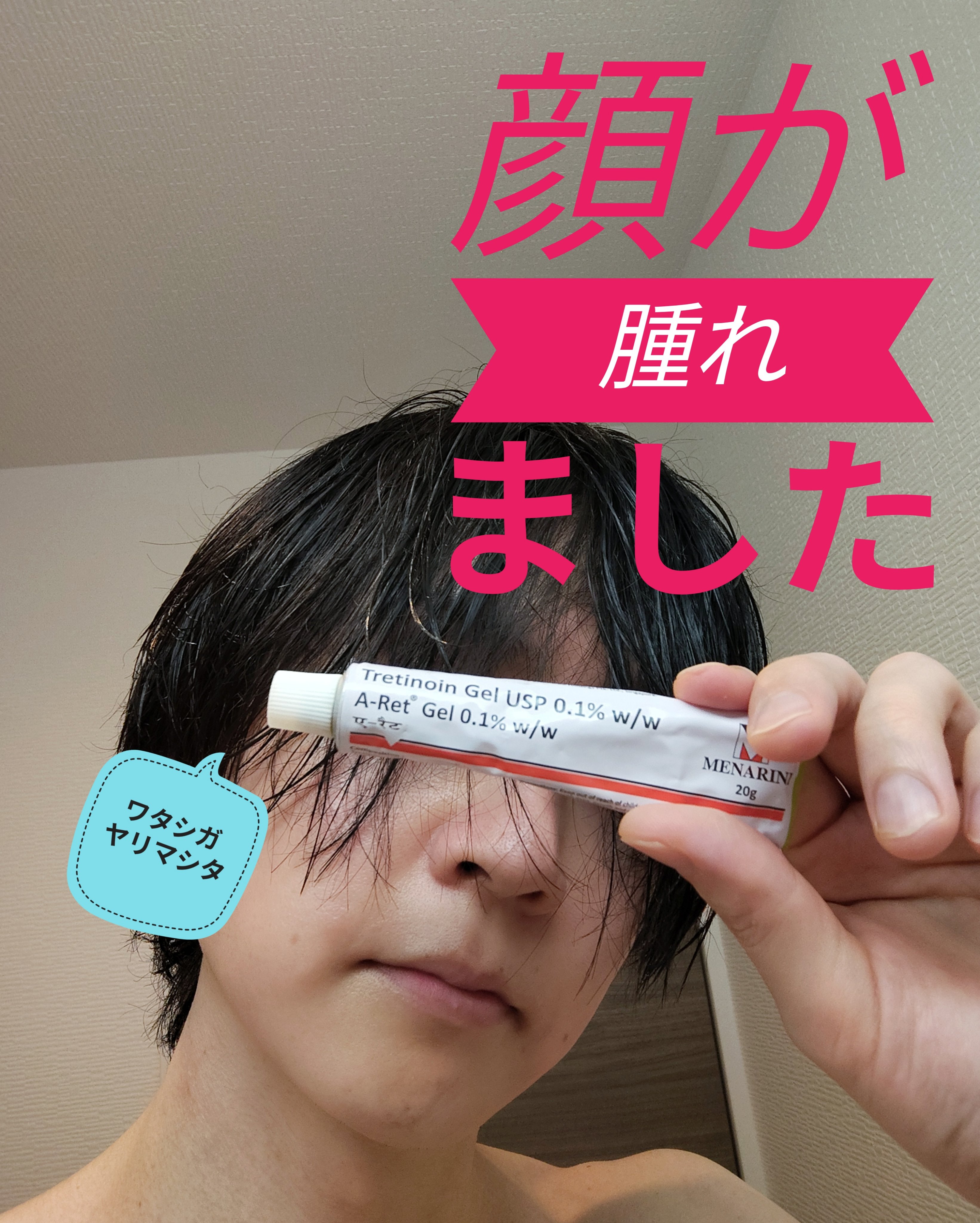 トレチノインジェル/A-Ret/美容液を使ったクチコミ（1枚目）