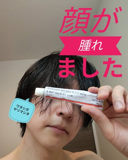 トレチノインジェル/A-Ret/美容液を使ったクチコミ(1枚目)