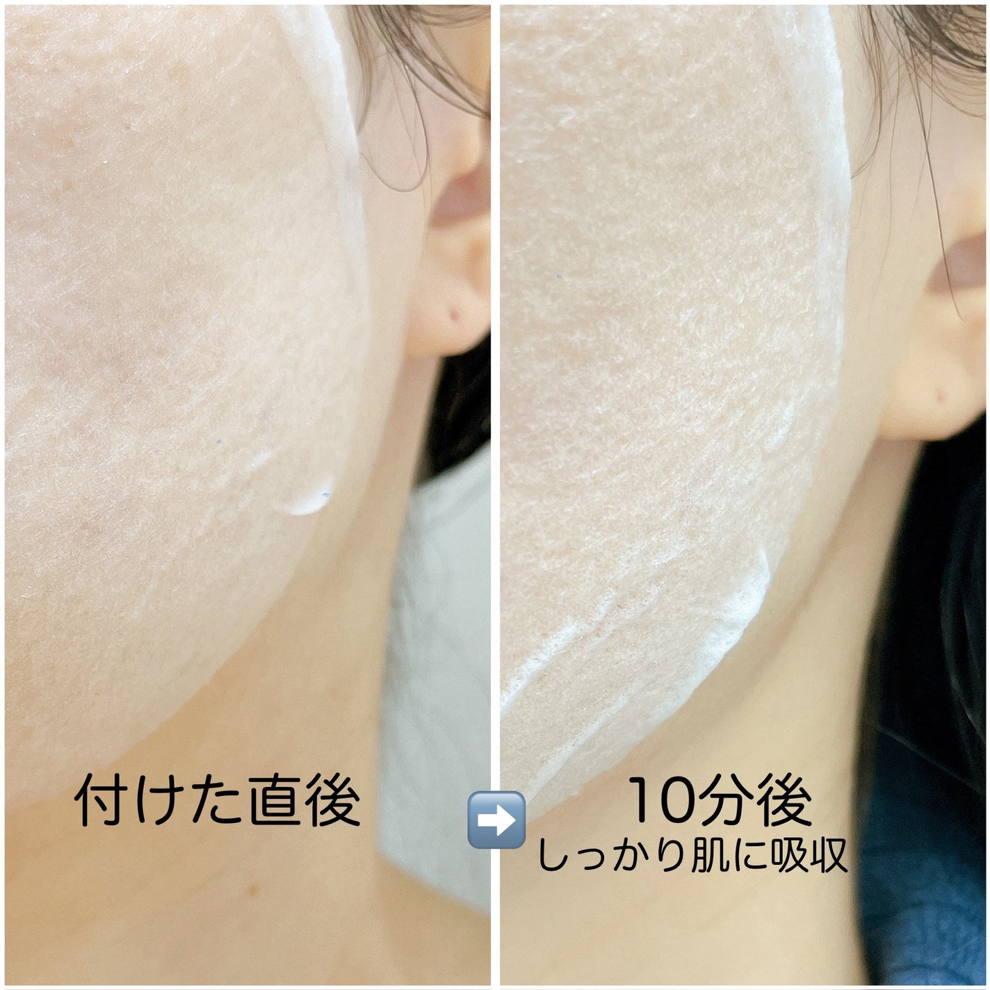 復活草シートマスクデイリーピック/Abib /シートマスク・パックを使ったクチコミ(3枚目)