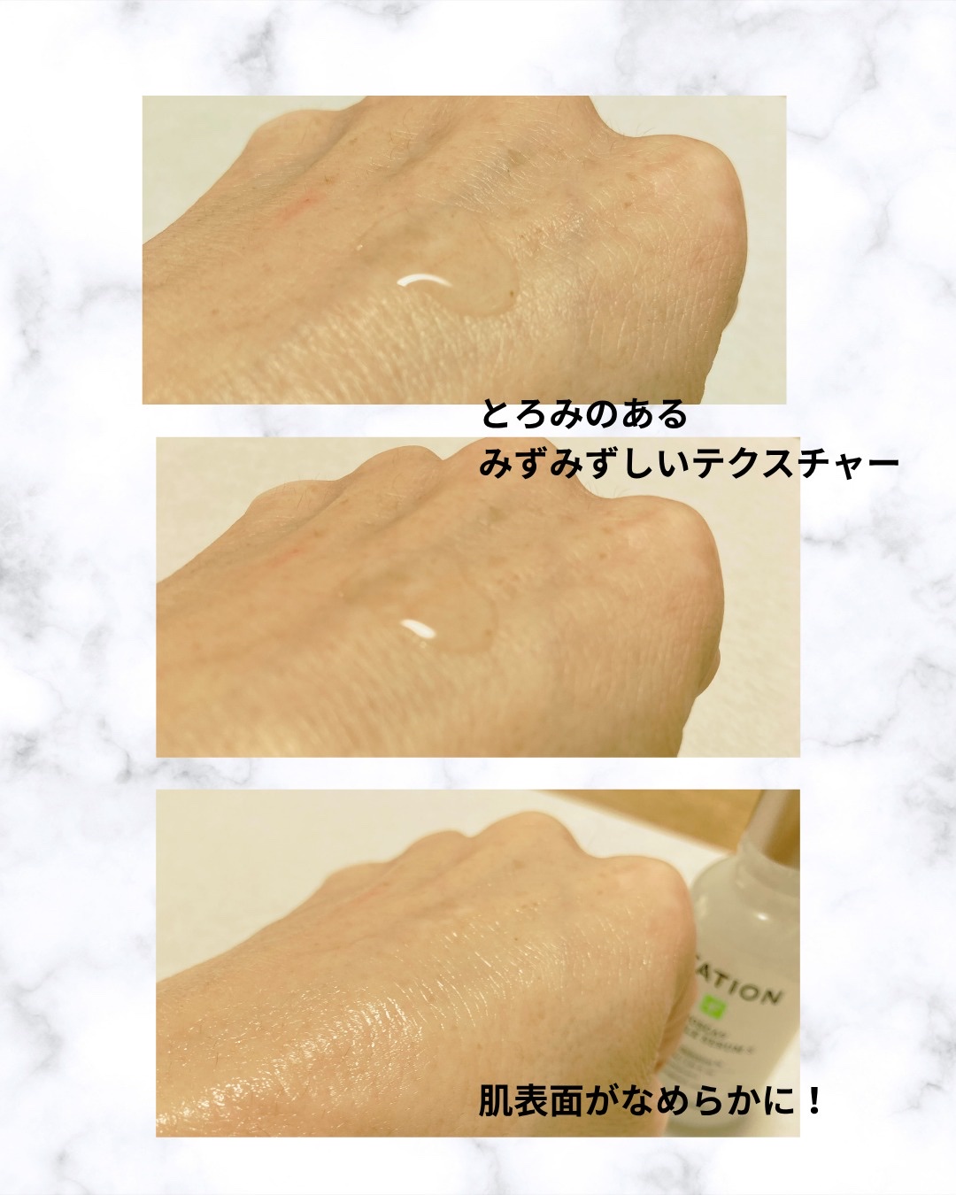 ノスカナイントラブルセラムS/FATION/美容液を使ったクチコミ（3枚目）