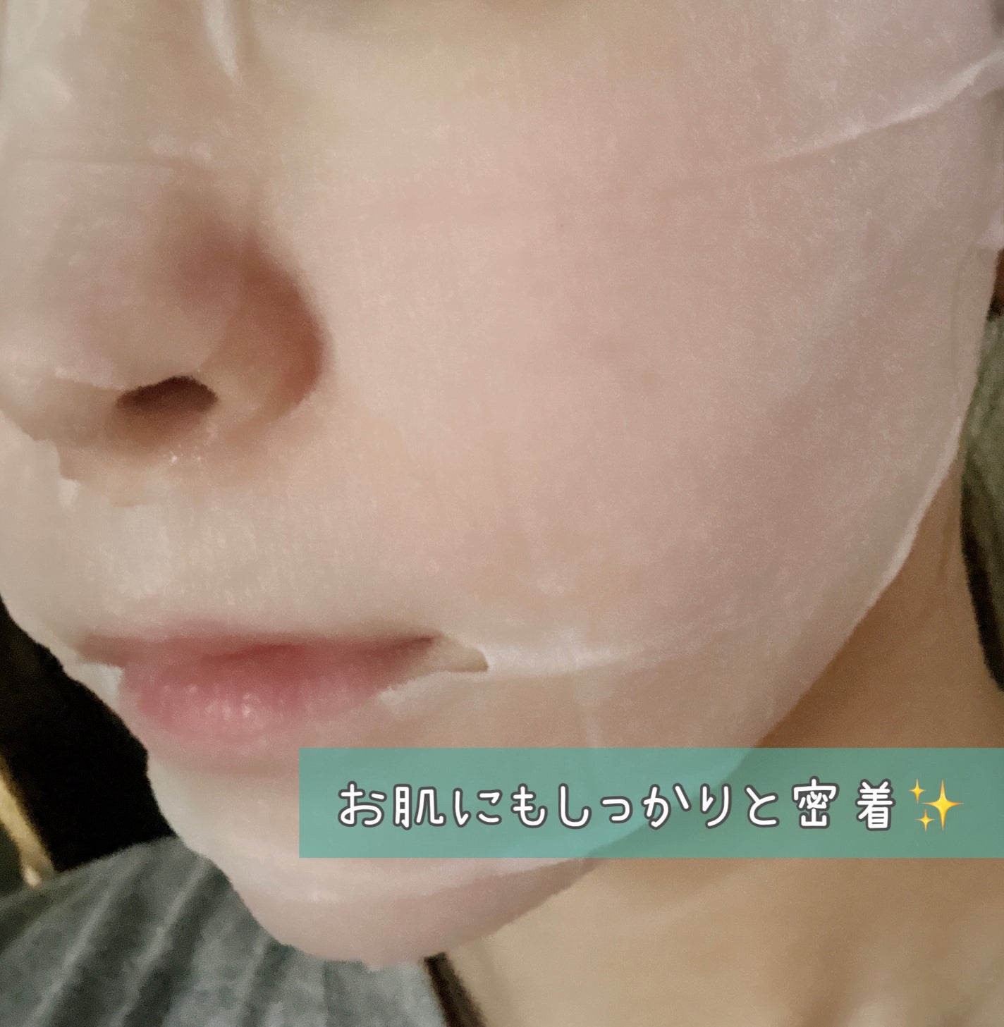 復活草シートマスクデイリーピック/Abib /シートマスク・パックを使ったクチコミ(3枚目)