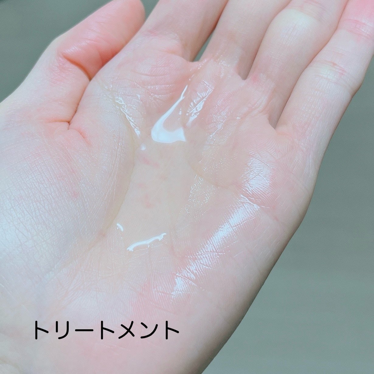 リカバリー オイルエッセンス/treecell/アウトバストリートメントを使ったクチコミ(2枚目)