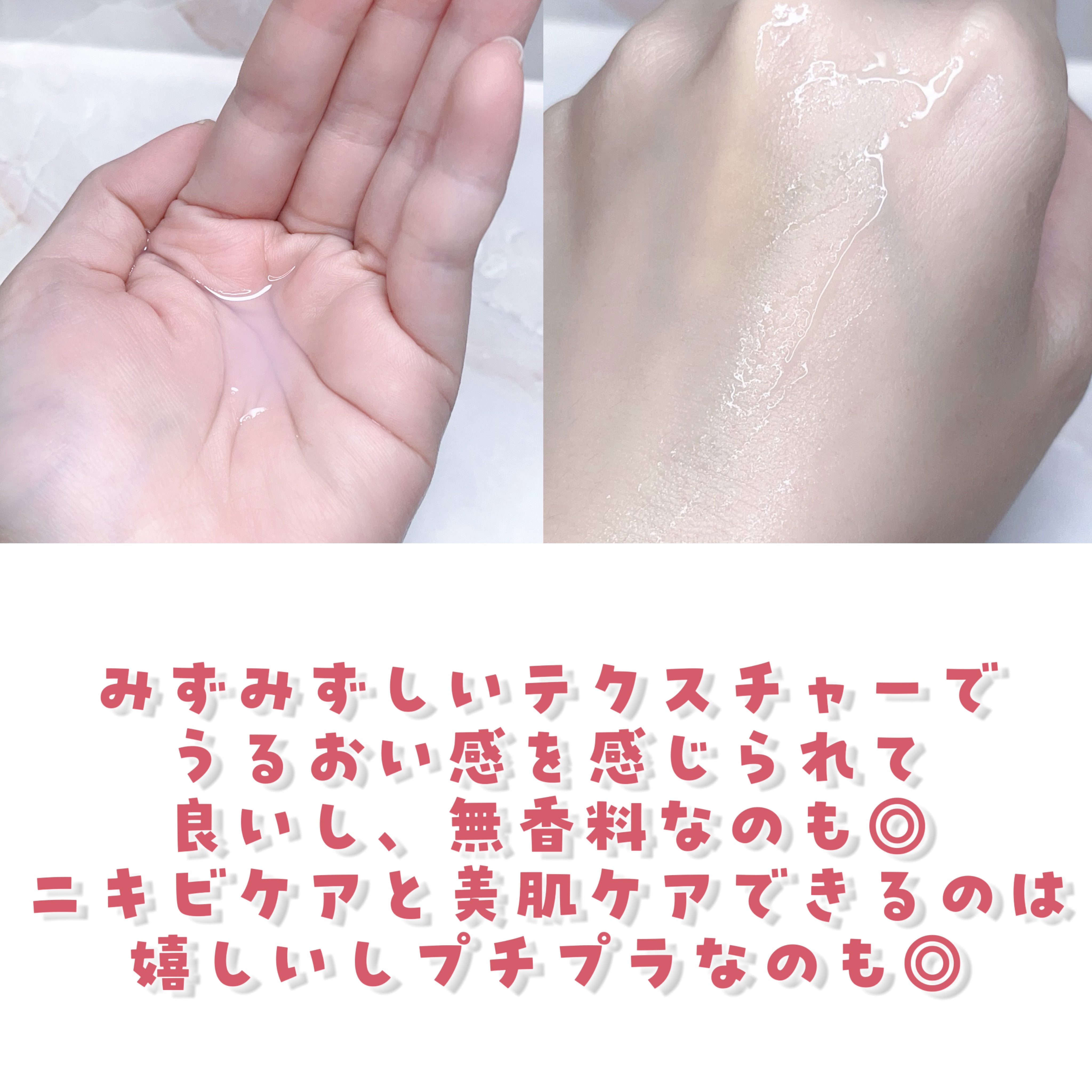 薬用化粧水/スキンライフ/化粧水を使ったクチコミ（3枚目）