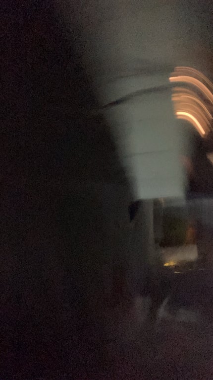 まろん on LIPS 「ちょっとだけましになりました、??白く綺麗にしたいです!どんな..」(1枚目)