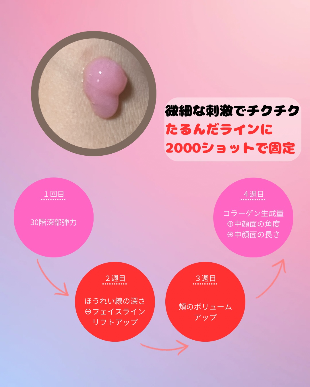 PDRNキューブセラム/DPPR/美容液を使ったクチコミ（2枚目）