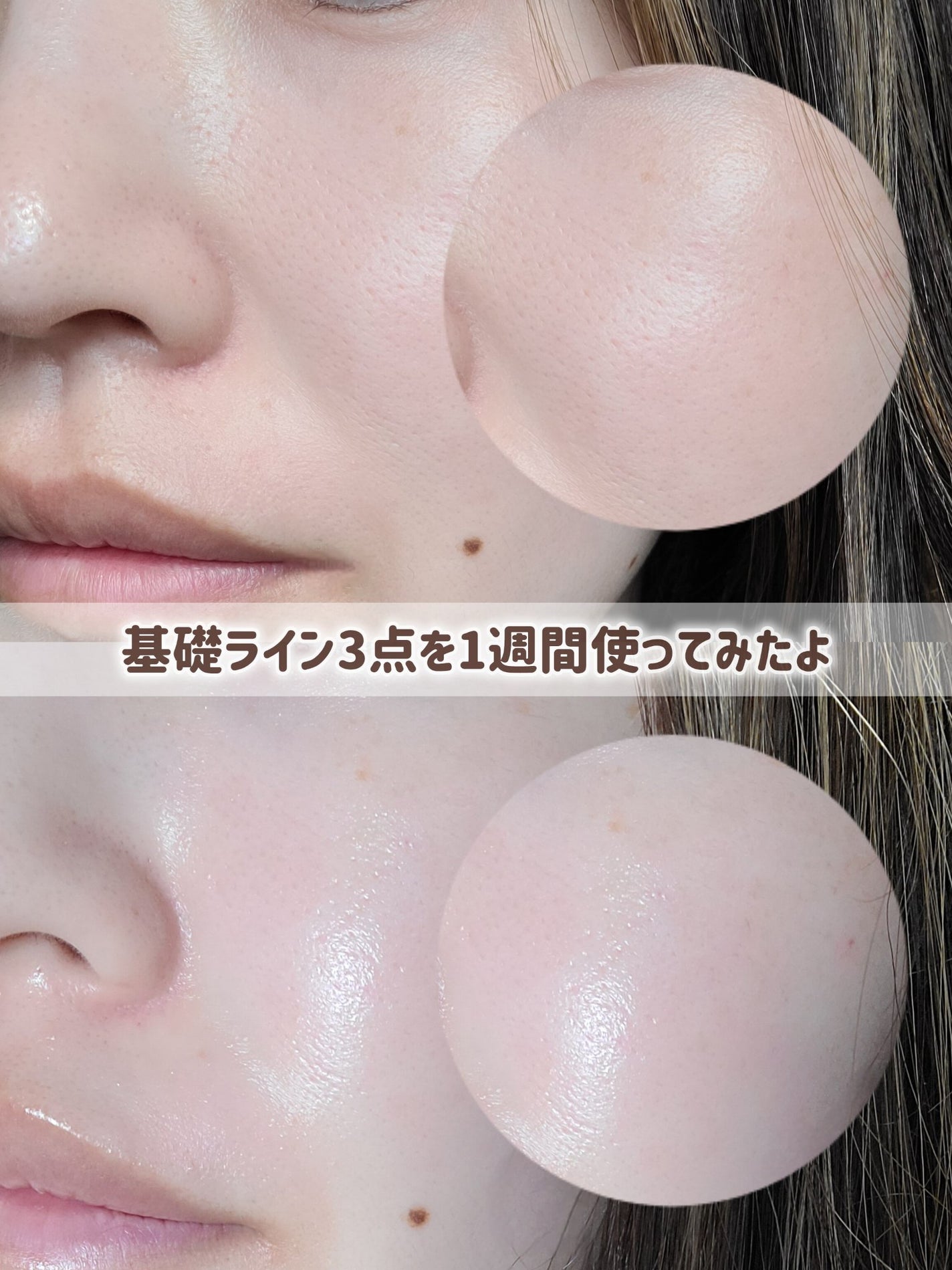 ダーマジェンシー ゼロカ86 トナー/DERMAGENCY/化粧水を使ったクチコミ(5枚目)