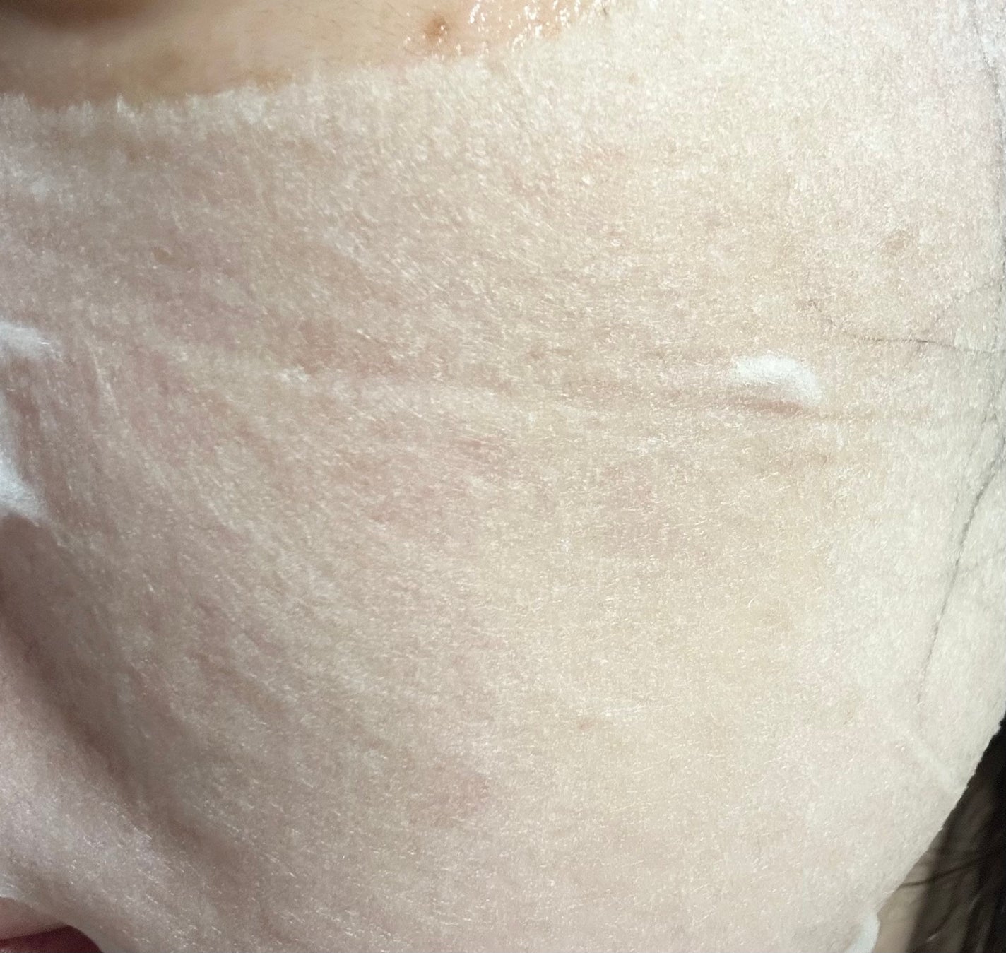 復活草シートマスクデイリーピック/Abib /シートマスク・パックを使ったクチコミ(4枚目)