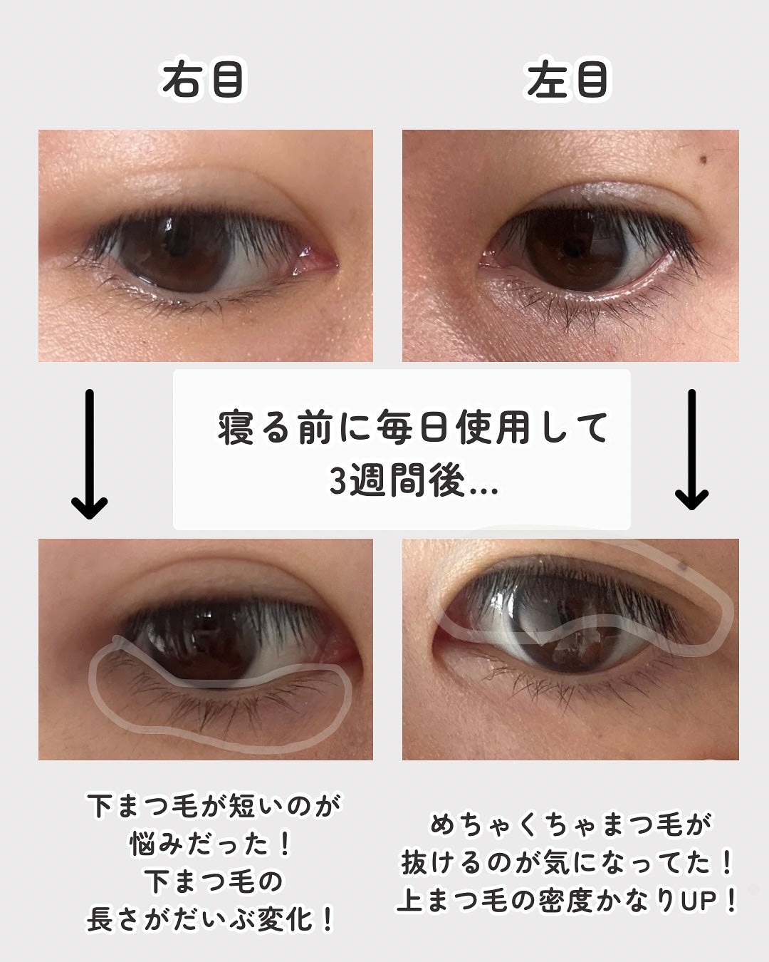 湘南美容まつ毛美容液PREMIUM/湘南美容/まつげ美容液を使ったクチコミ(4枚目)