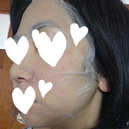 ドクダミシートマスクデイリーピック/Abib /シートマスク・パックを使ったクチコミ(4枚目)