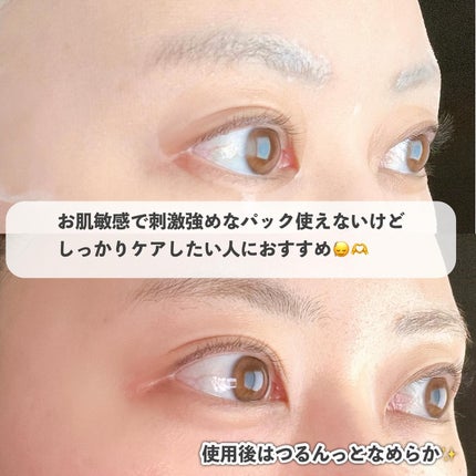 ダーマレーザー スーパーPDRN+VC100マスク/クオリティファースト/シートマスク・パックを使ったクチコミ(7枚目)