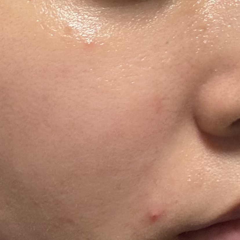 潤浸保湿 化粧水 II しっとり/キュレル/化粧水を使ったクチコミ（2枚目）