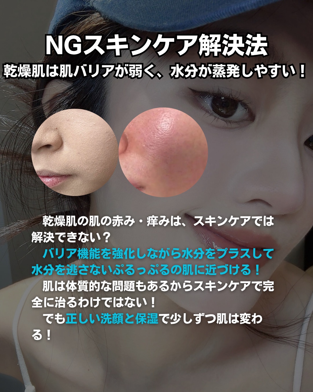 アネトス バランシング トリートメントクリーム/Anetos/フェイスクリームを使ったクチコミ（3枚目）