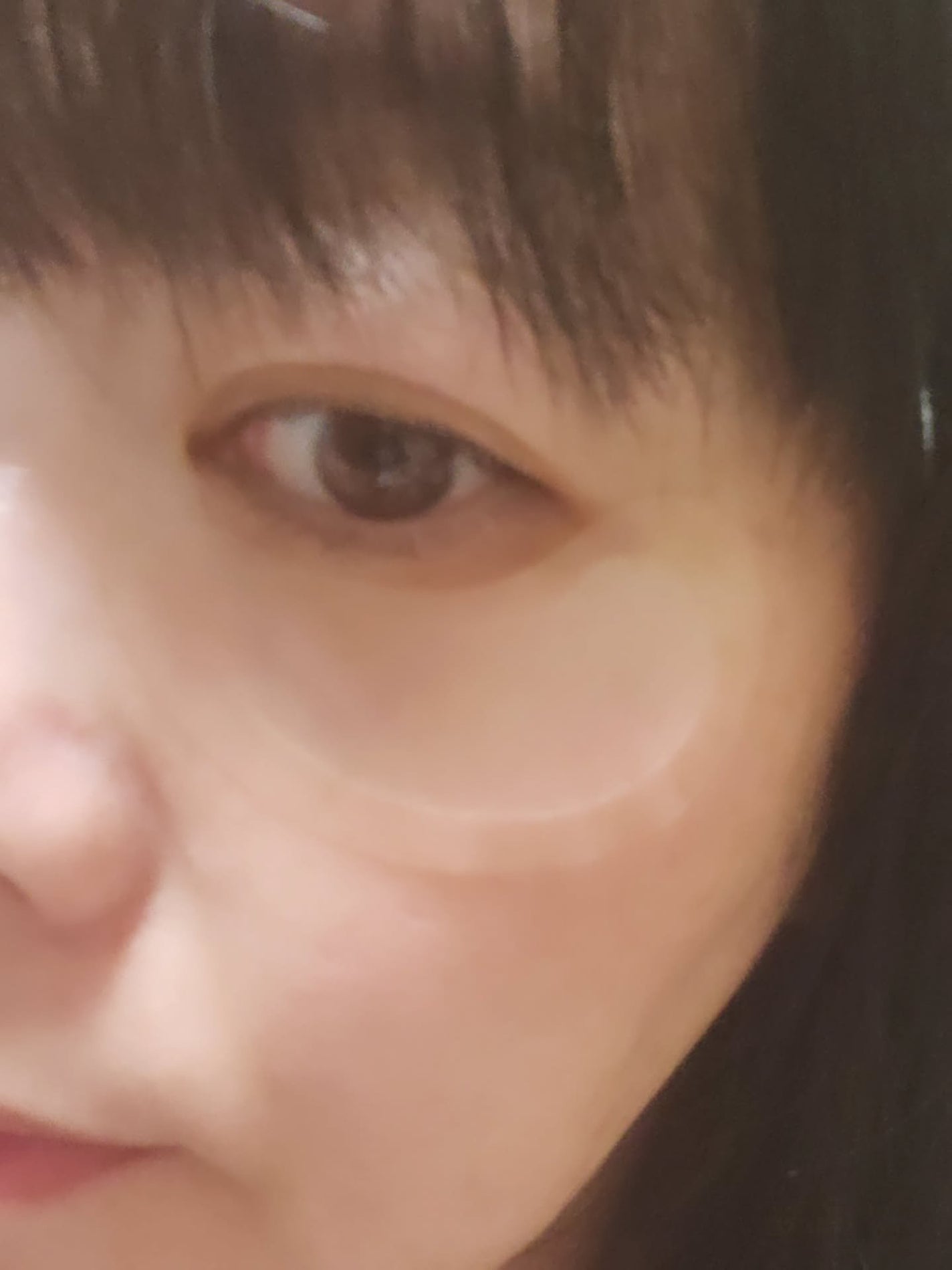 アイバックリフト1100シャットリードルパッチ/CHARDE/シートマスク・パックを使ったクチコミ(3枚目)