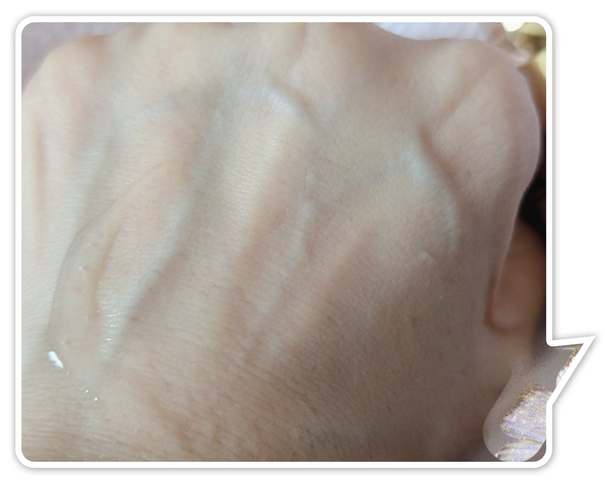 リソウ リペアビューティーエッセンス AP/リソウコーポレーション/美容液を使ったクチコミ（3枚目）