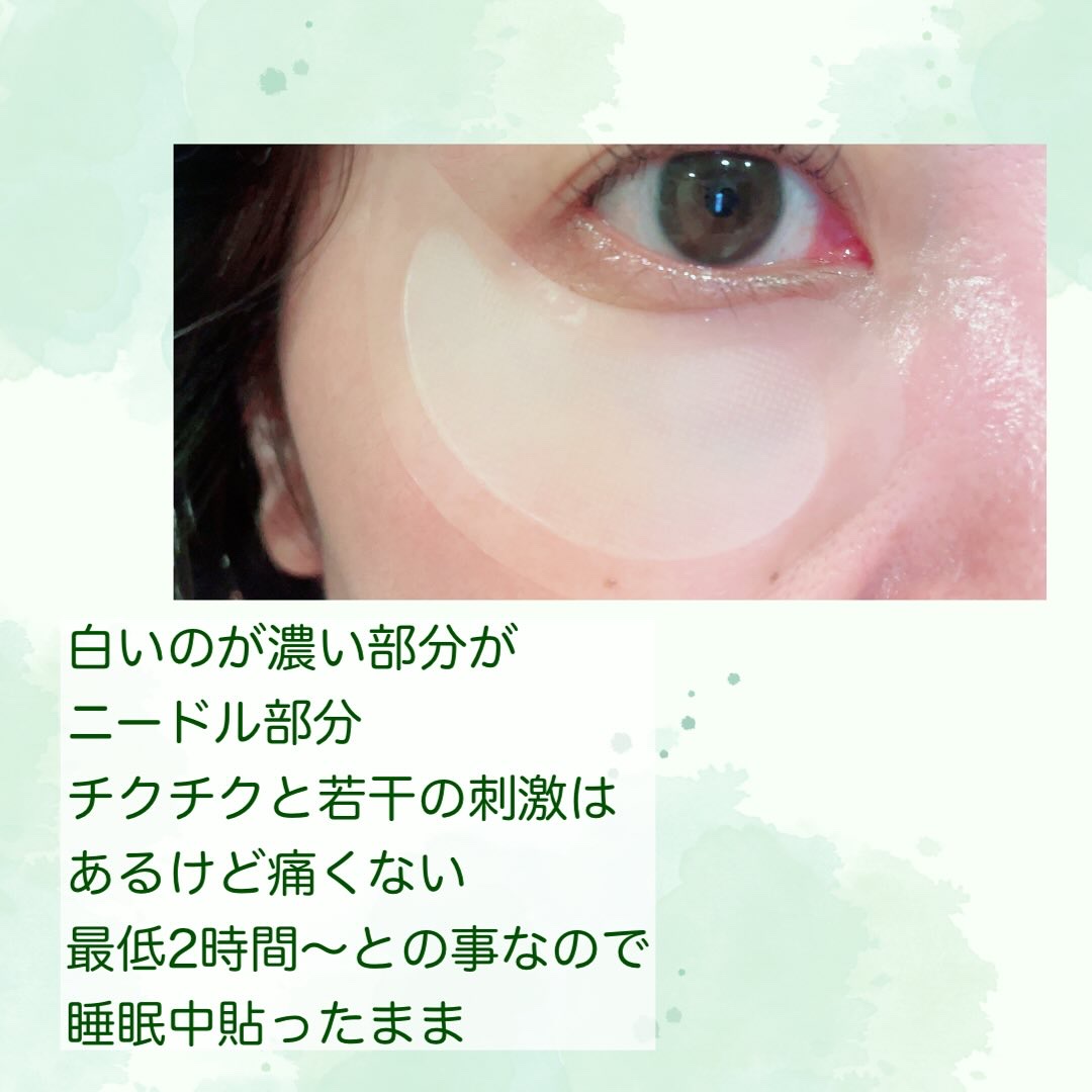 アイバックリフト1100シャットリードルパッチ/CHARDE/シートマスク・パックを使ったクチコミ（2枚目）