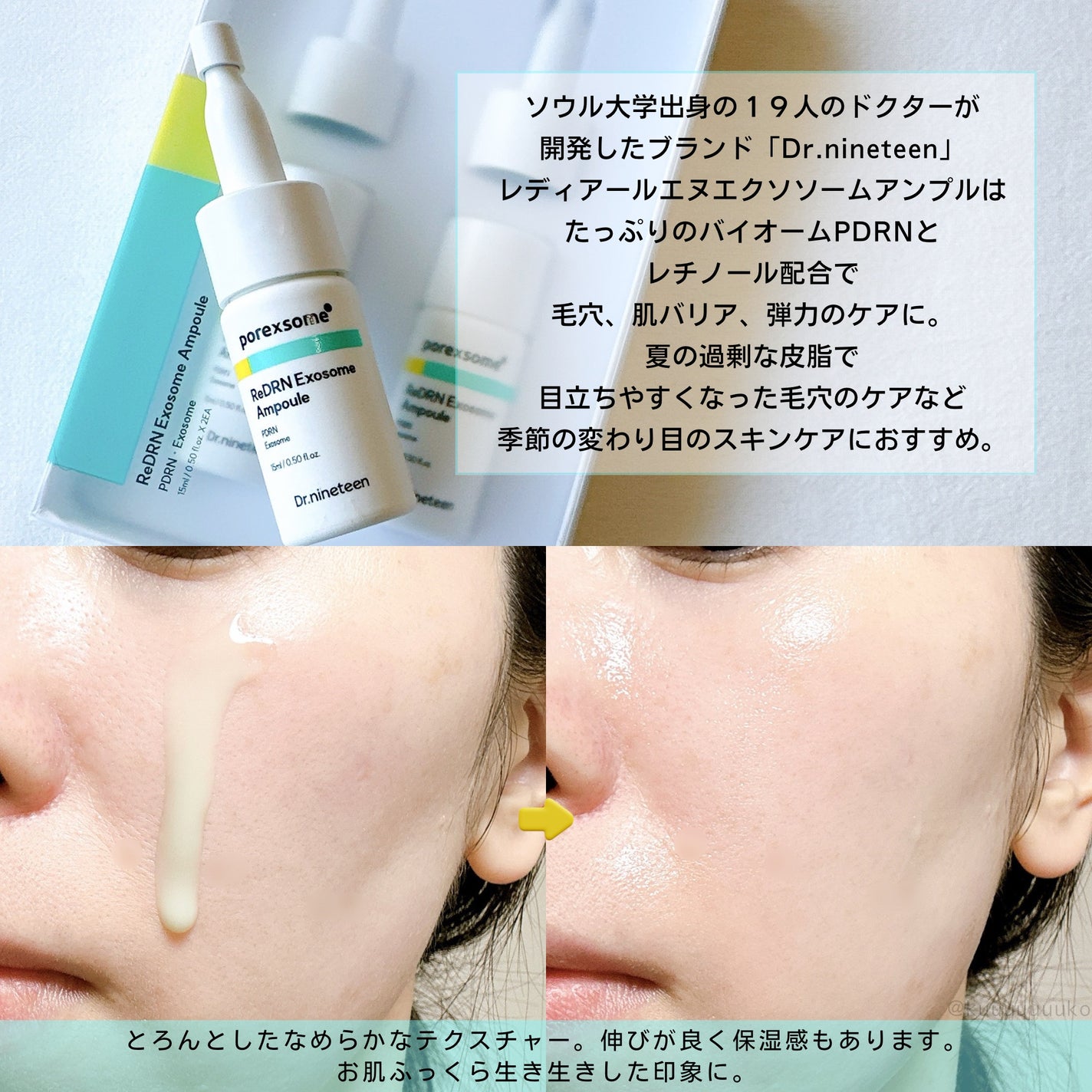 ReDRNエクソソームアンプル/Dr.nineteen/美容液を使ったクチコミ(2枚目)