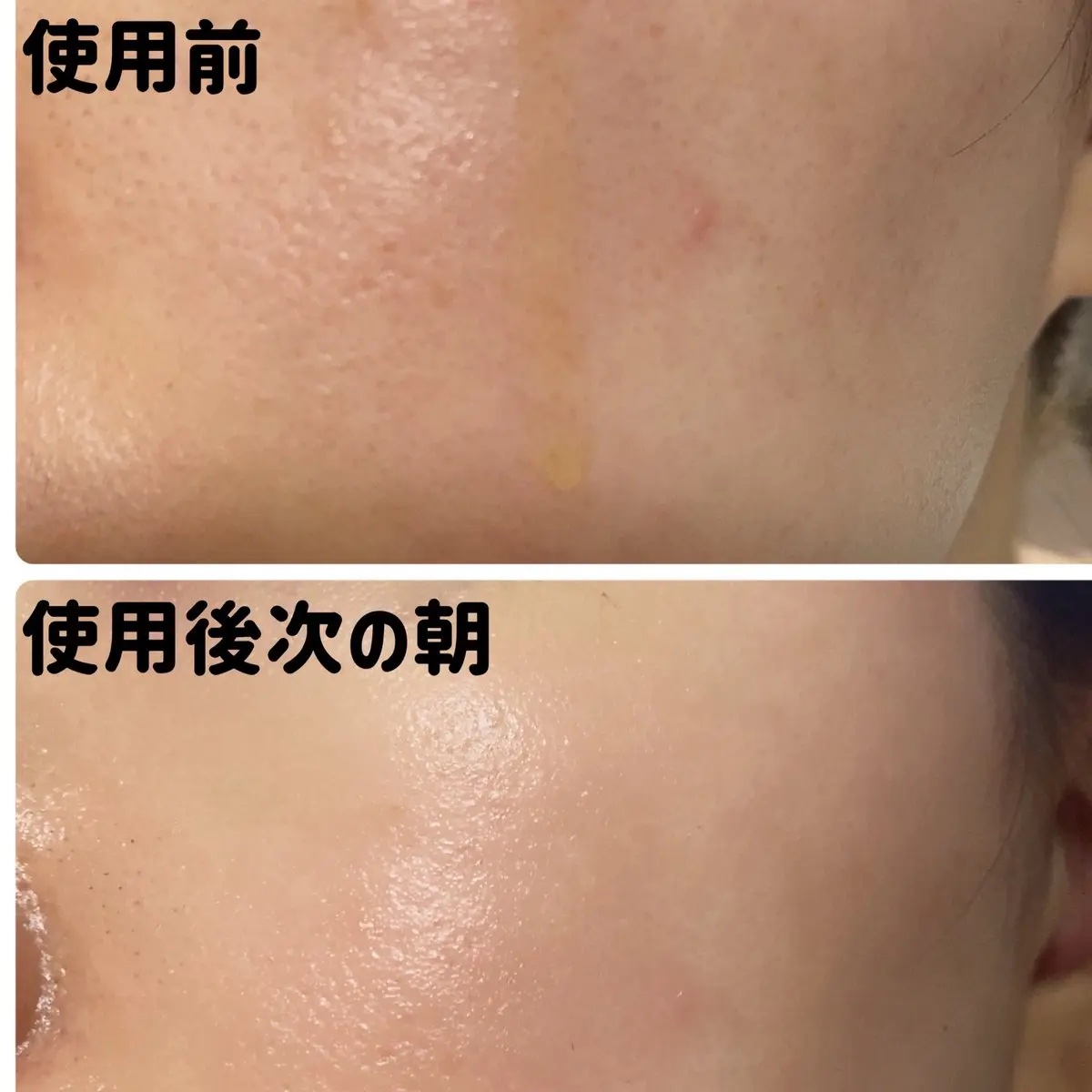 オリジンビタミンC25美容液/COSNORI/美容液を使ったクチコミ（3枚目）