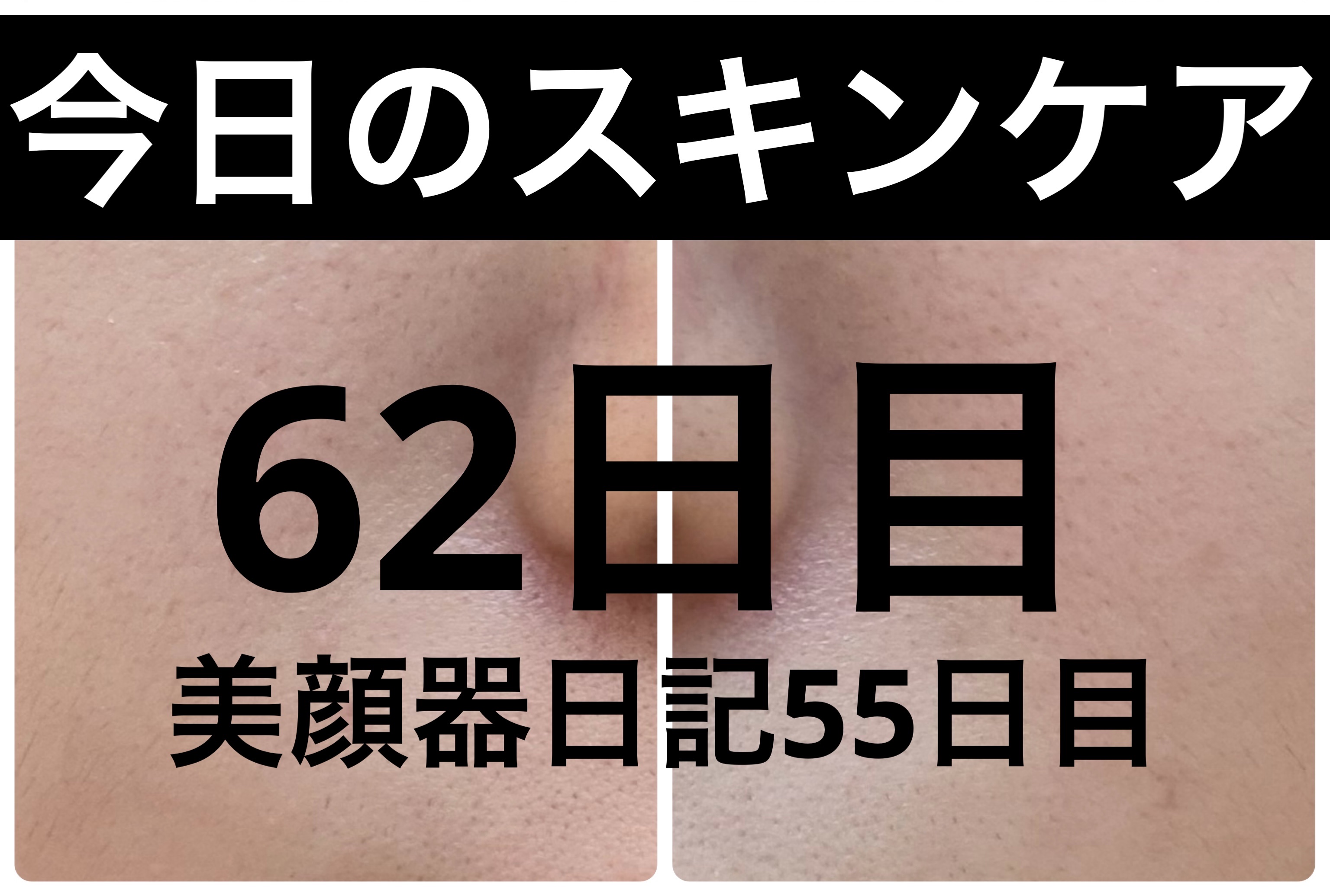 GLAM UP炭酸泡クレイマスク/GLAM UP/洗い流すパック・マスクを使ったクチコミ（1枚目）