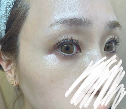 背中ニキビ メルティング ジェルクリーム ルフティグ/ODELOI/ボディクリームを使ったクチコミ(4枚目)