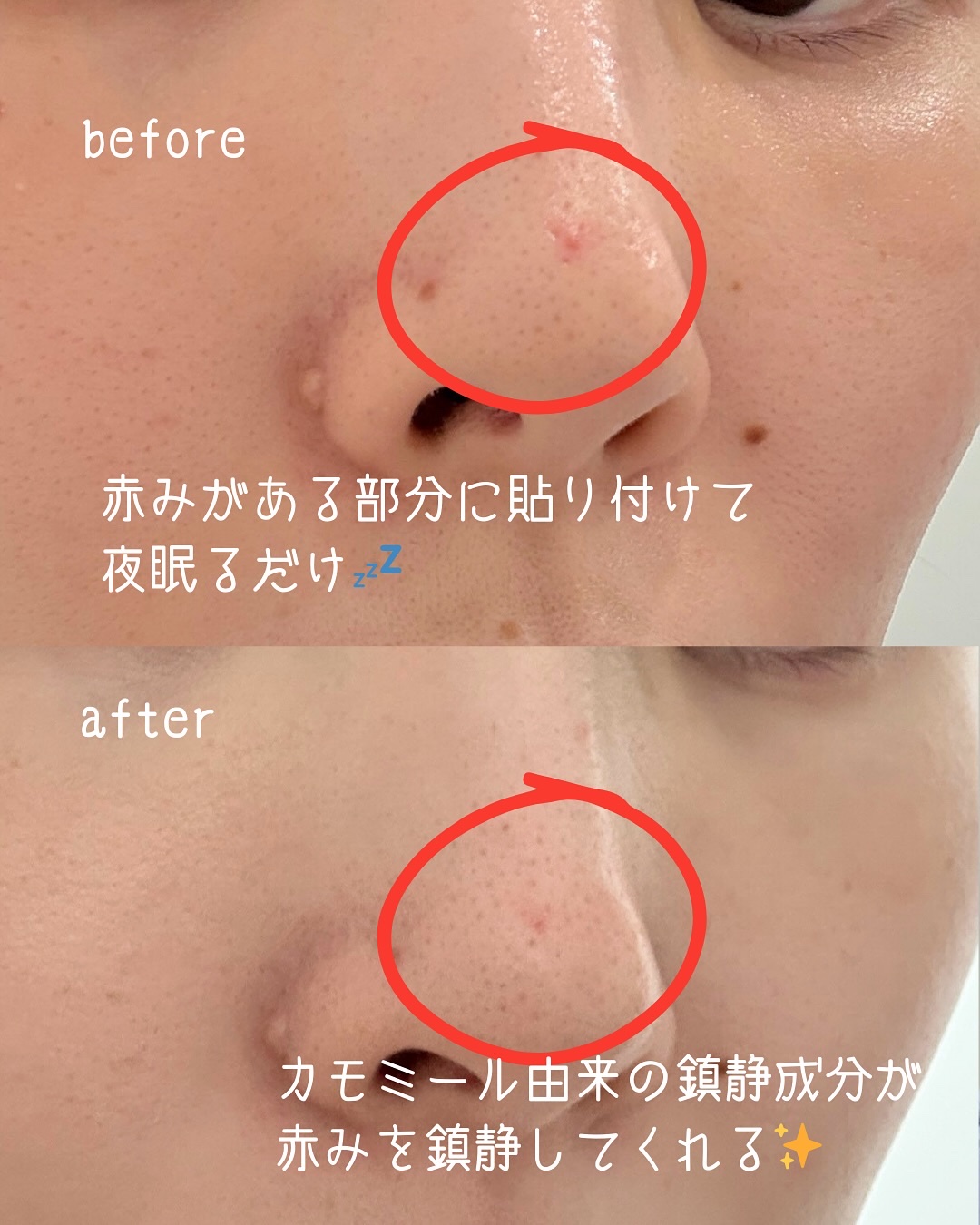 ベルフラワーナイトパッチ/hwarang’ /その他スキンケアを使ったクチコミ（3枚目）