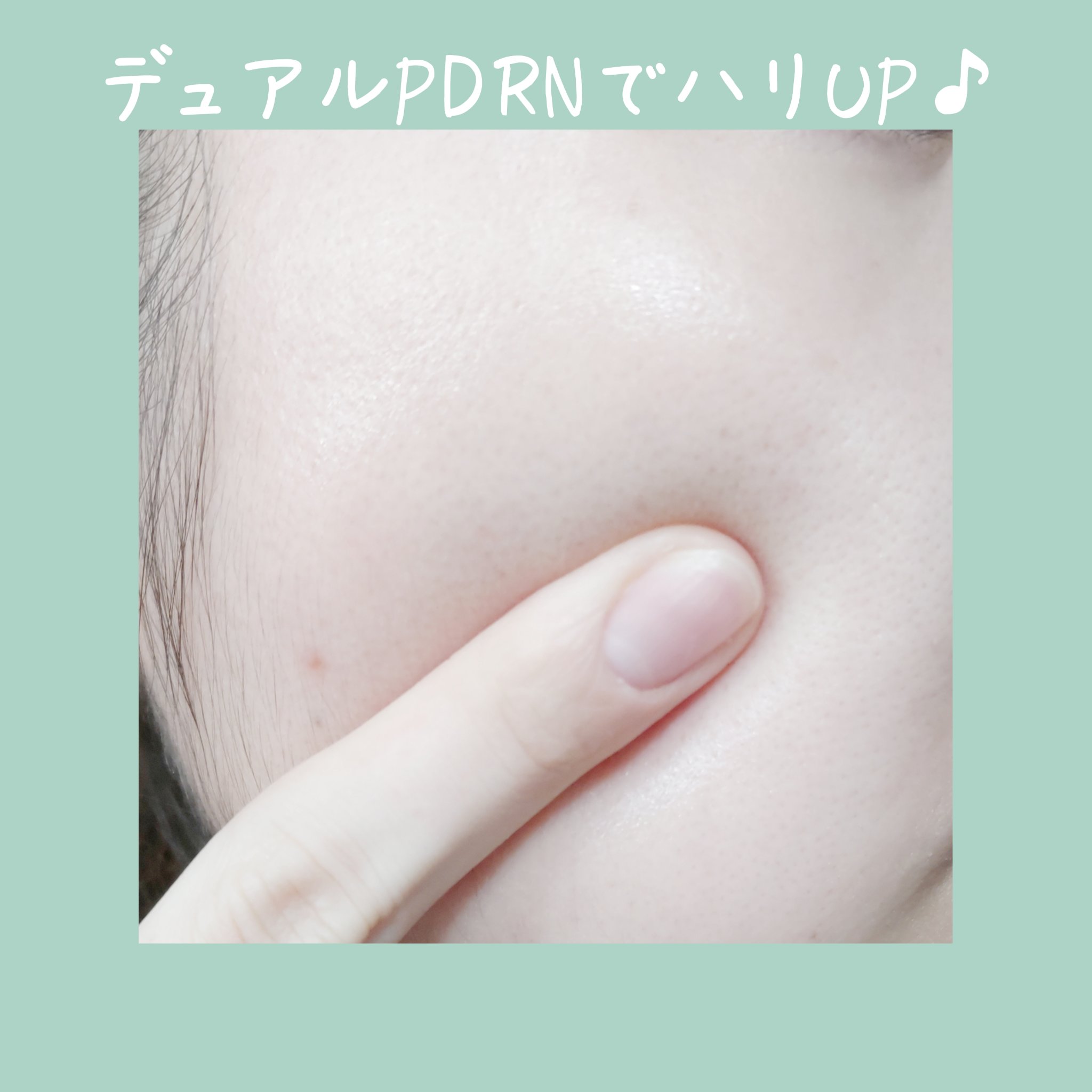 デュアルPDRNカーミングクリーム/MEDI IN LAB/フェイスクリームを使ったクチコミ（3枚目）