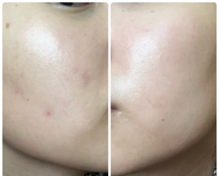 ぽむ on LIPS 「1枚目 2025.10.28エピデュオ 776日目2枚目 20..」(5枚目)