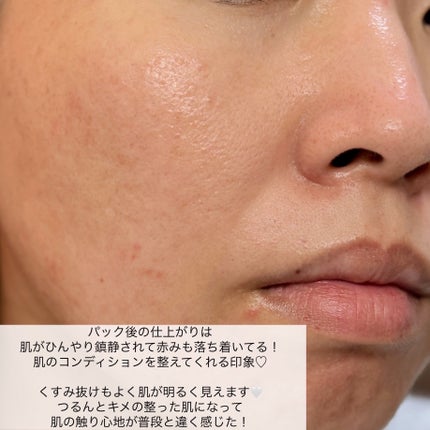 ナノステップ コラーゲン メルティングマスク/from medi+/シートマスク・パックを使ったクチコミ(5枚目)