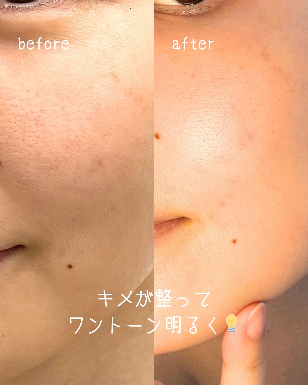 ドクタージー ピュア ビタミンC ブライトニングマスク/Dr.G/シートマスク・パックを使ったクチコミ（3枚目）