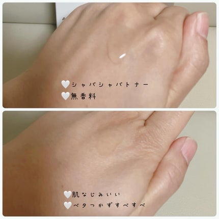 9倍濃縮ドクダミトナー/BlancNature/化粧水を使ったクチコミ(2枚目)