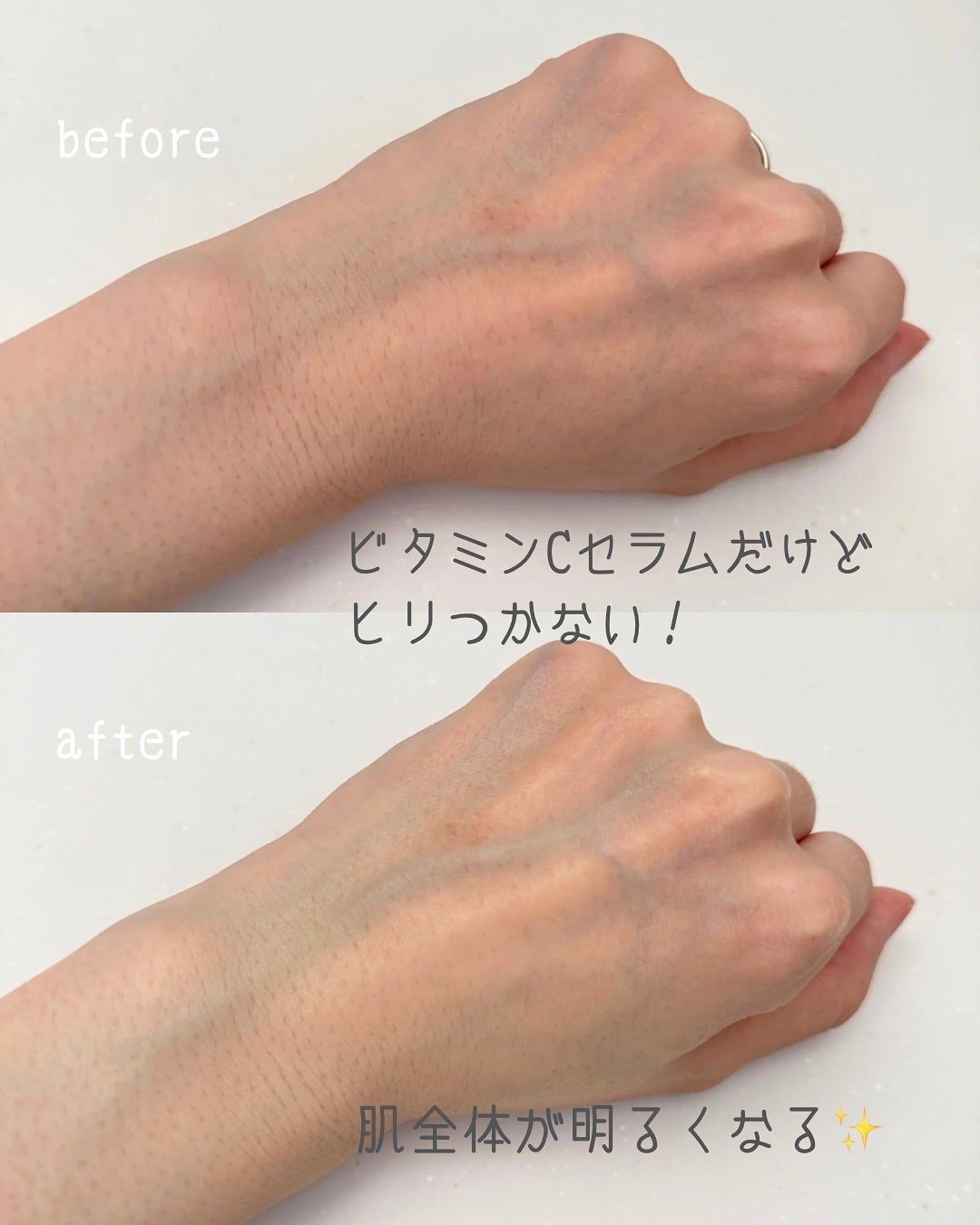 CICAビタミンCセラム/Meebak/美容液を使ったクチコミ(3枚目)