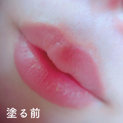 ã«ã³ã ðž on LIPS ããã€ã¯ãããŒãã«å
¥ããªããçŸå®¹æ¶²ð/MWAHNEEDLELIP..ãïŒ3æç®ïŒ