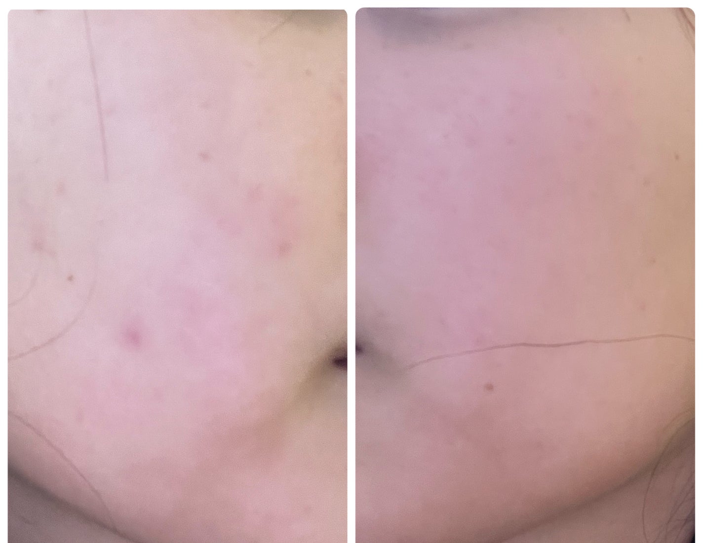 ぽむ on LIPS 「1枚目 2025.10.28エピデュオ 776日目2枚目 20..」(2枚目)