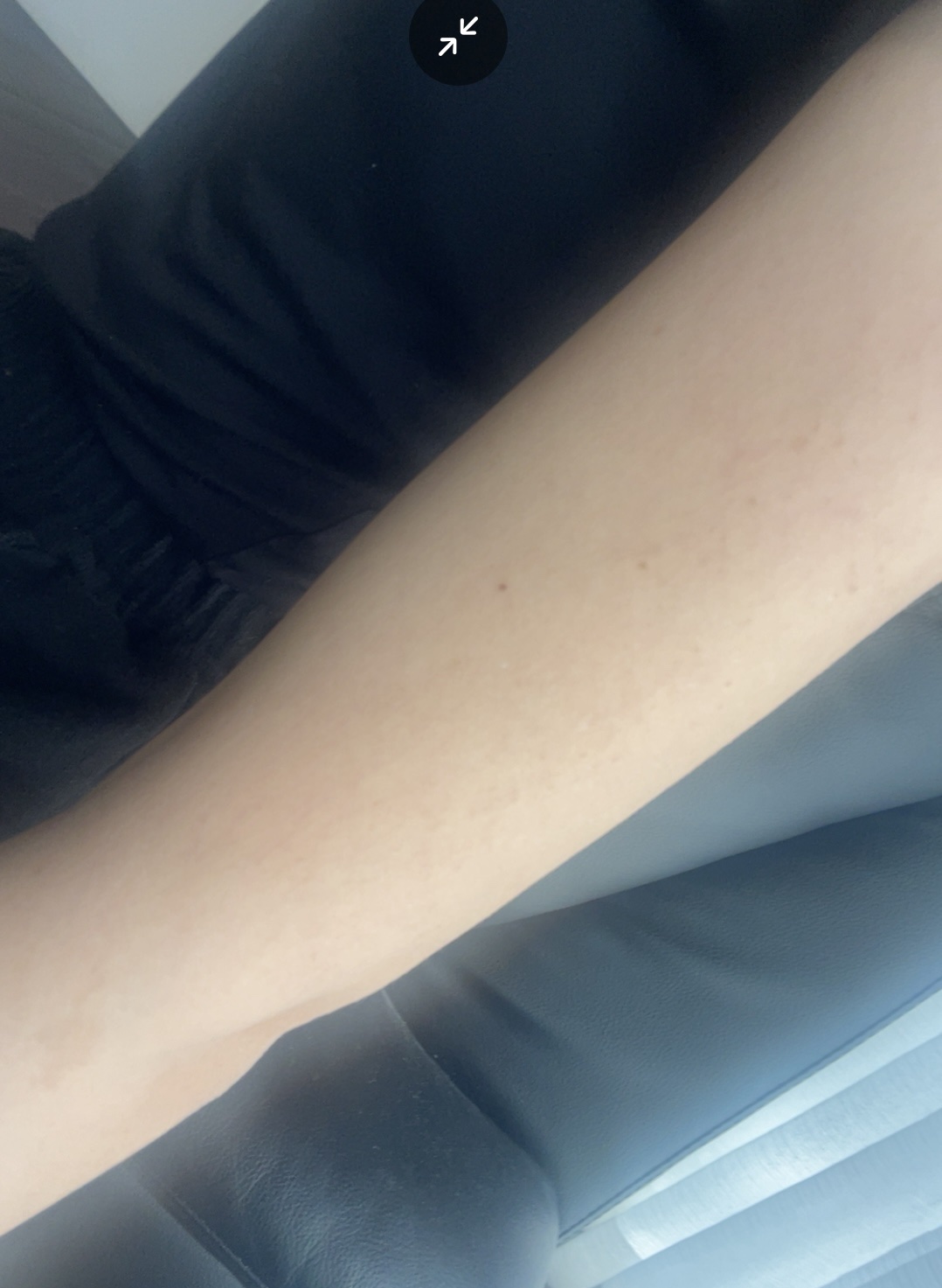 背中ニキビ用メルティングジェルクリーム ルフティグ/ODELOI/ボディクリームを使ったクチコミ（3枚目）