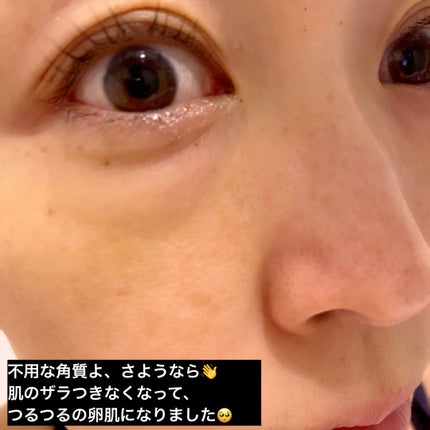 ãã£ãŒããªãŒããŒãããŒãªã³ã°ããã¯/WellDerma/æŽãæµãããã¯ã»ãã¹ã¯ã䜿ã£ãã¯ãã³ãïŒ4æç®ïŒ