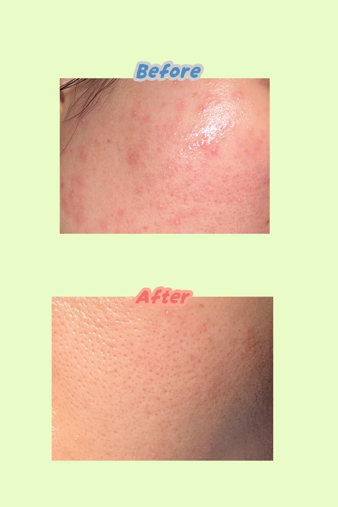 バランスフル シカセラム/Torriden/美容液を使ったクチコミ（2枚目）