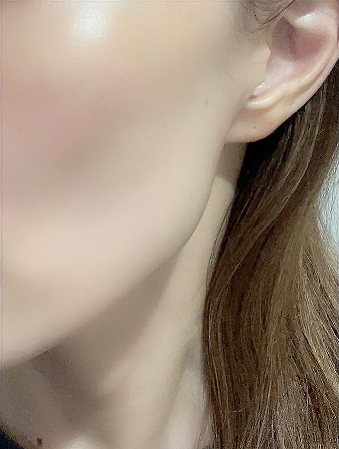 ダブル セーラム ADC/CLARINS/美容液を使ったクチコミ(6枚目)