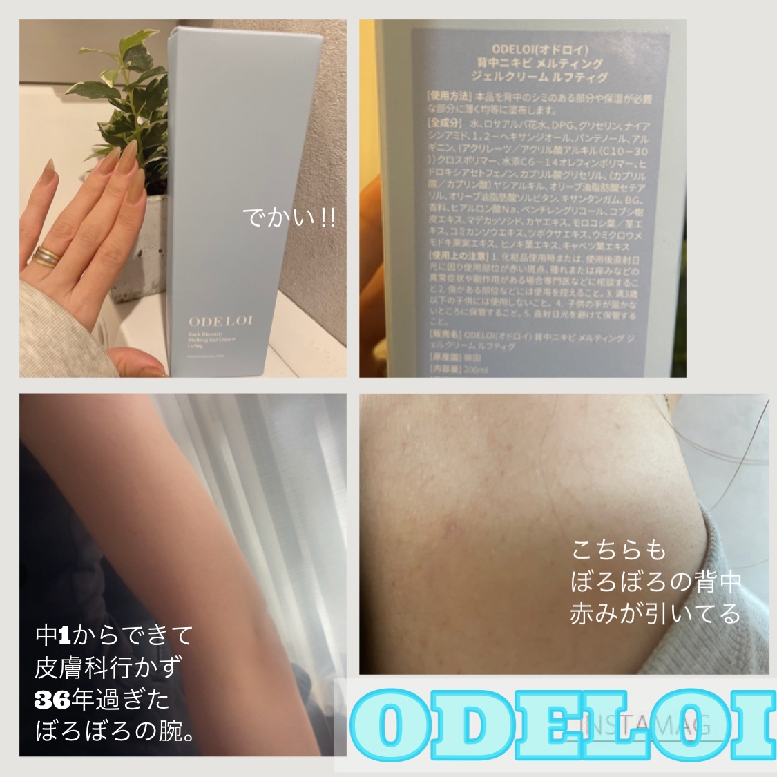 背中ニキビ用メルティングジェルクリーム ルフティグ/ODELOI/ボディクリームを使ったクチコミ（1枚目）