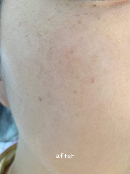 SIGNATURE ESSENCE COVER PACT /AGE20’s/クリーム・エマルジョンファンデーションを使ったクチコミ(7枚目)