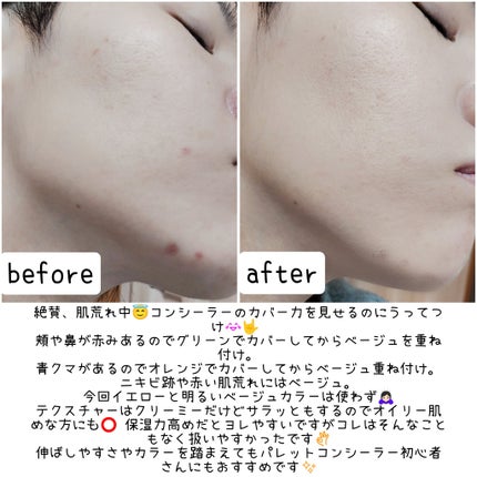 コンシールブレンダーパレット/LUNA/パレットコンシーラーを使ったクチコミ(5枚目)