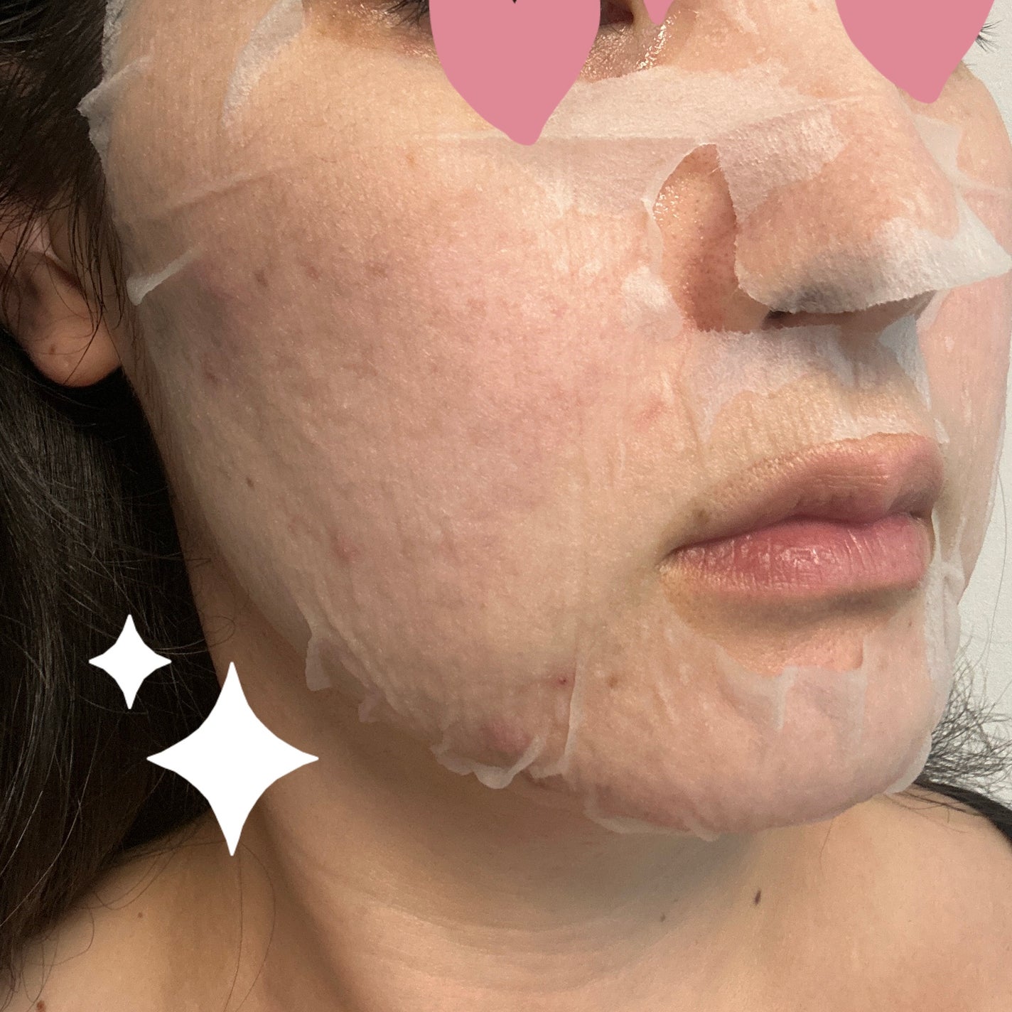 復活草シートマスクデイリーピック/Abib /シートマスク・パックを使ったクチコミ(3枚目)