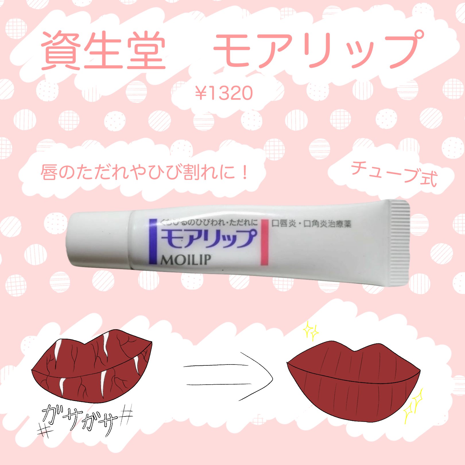 モアリップ N (医薬品)/資生堂薬品/その他を使ったクチコミ（1枚目）