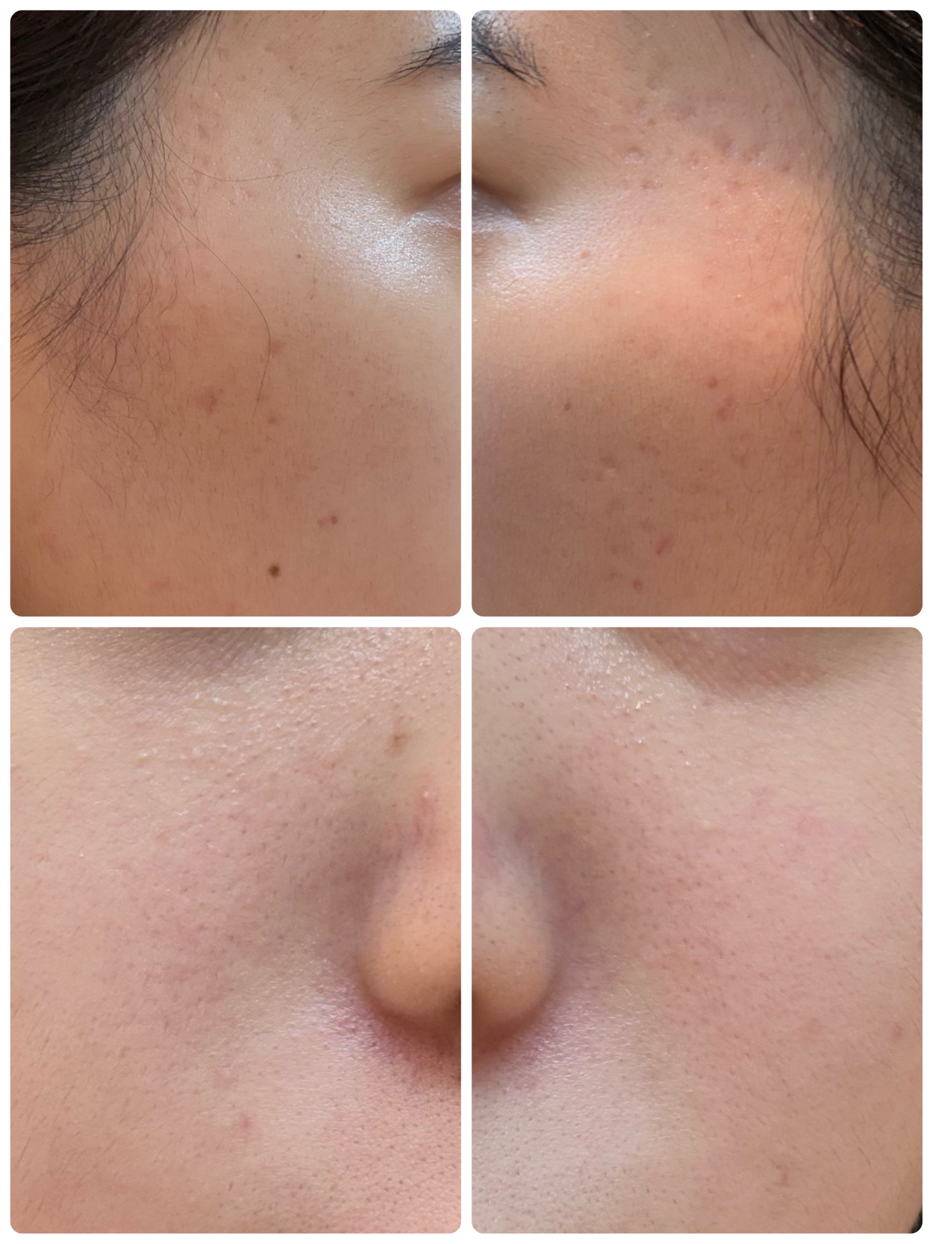 GLAM UP炭酸泡クレイマスク/GLAM UP/洗い流すパック・マスクを使ったクチコミ（2枚目）