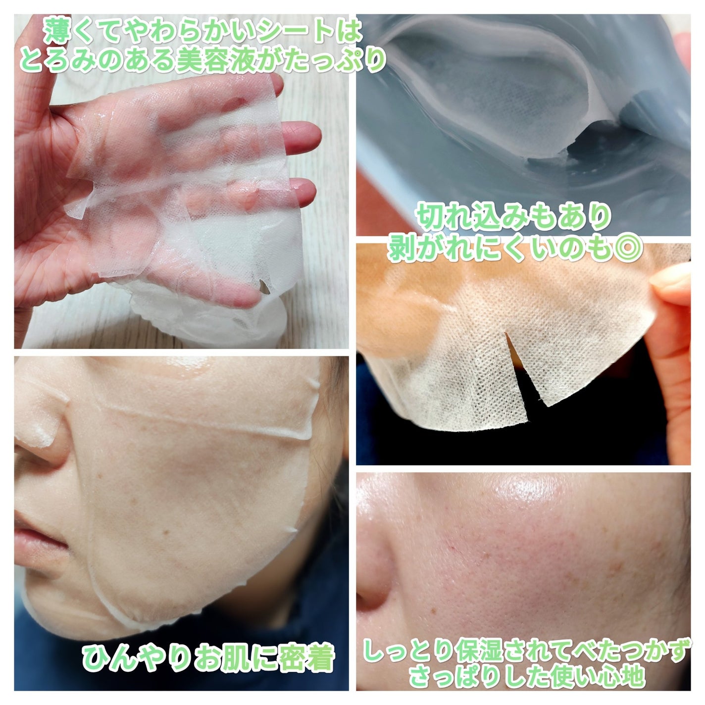 ちぃぼー on LIPS 「#PRこのマスク1枚で鎮静+バリア+ハリケア✨ジピダーム(@z..」(2枚目)