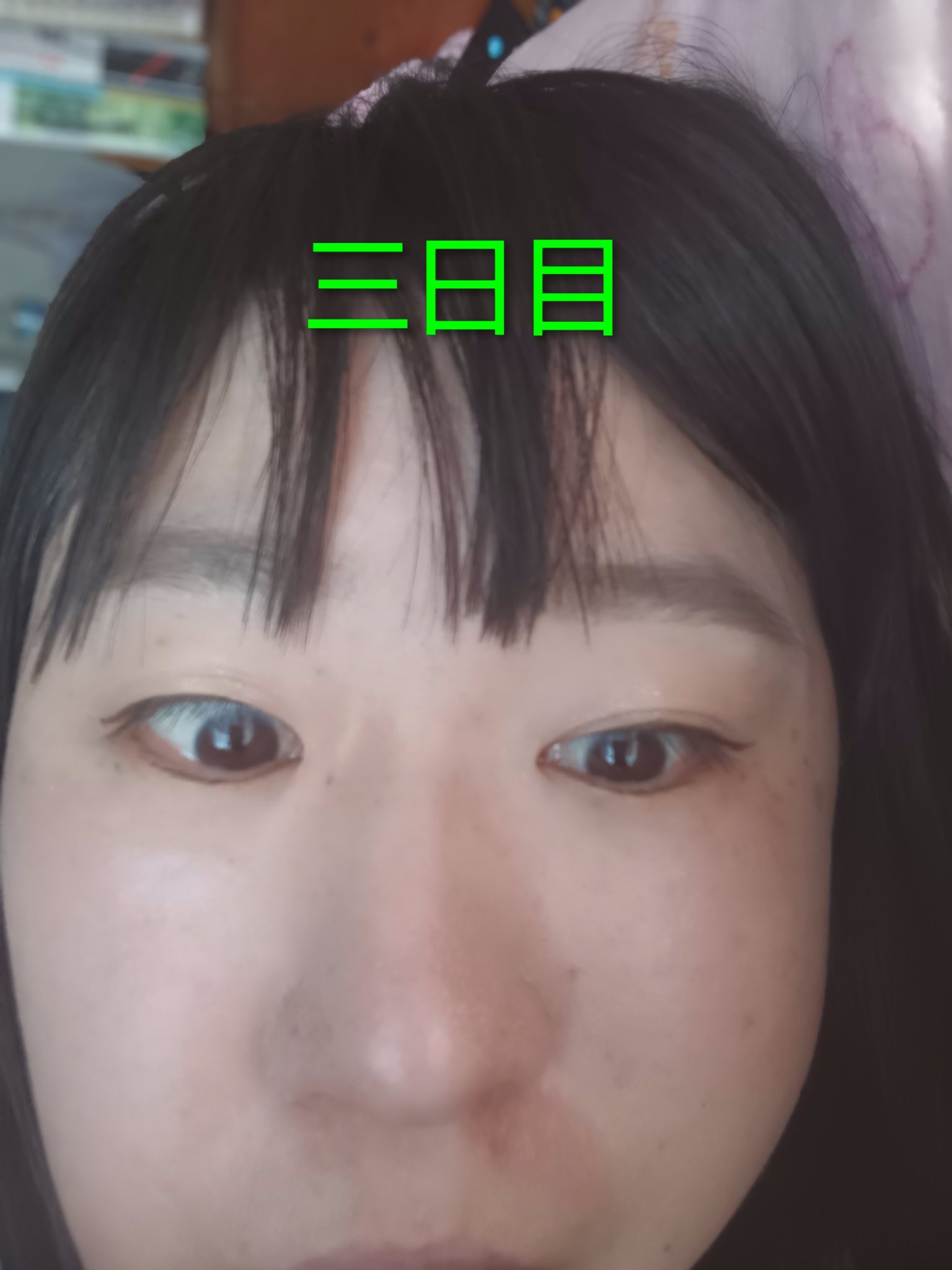 ローヤルゼリー配合 栄養ローション/DAISO/美容液を使ったクチコミ（3枚目）