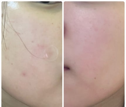 ぽむ on LIPS 「1枚目 2025.10.28エピデュオ 776日目2枚目 20..」(3枚目)