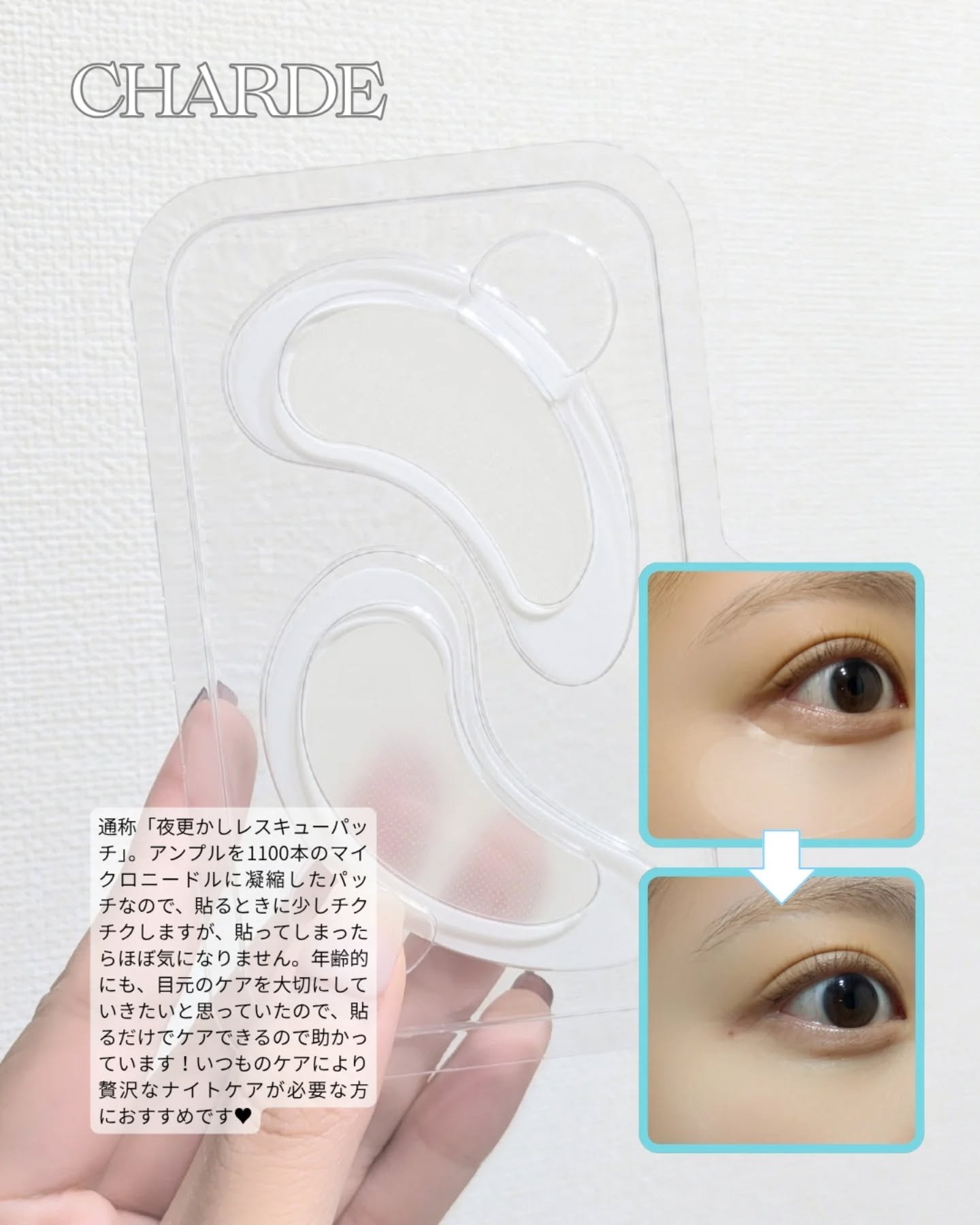 アイバックリフト1100シャットリードルパッチ/CHARDE/シートマスク・パックを使ったクチコミ（3枚目）